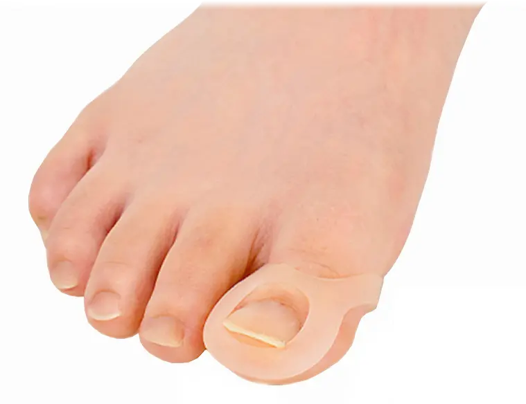 巻き爪ゲルサポーター